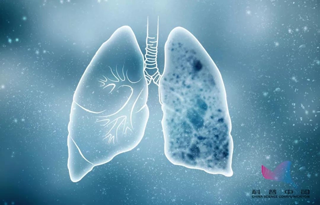 国家发布最新防控指南：结核病体检结果，将纳入学生健康档案(图2)