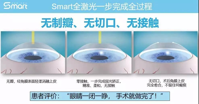 【关注】女兵报名已经开始，可视力不达标怎么办？(图7)