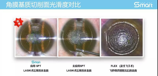 【关注】女兵报名已经开始，可视力不达标怎么办？(图8)