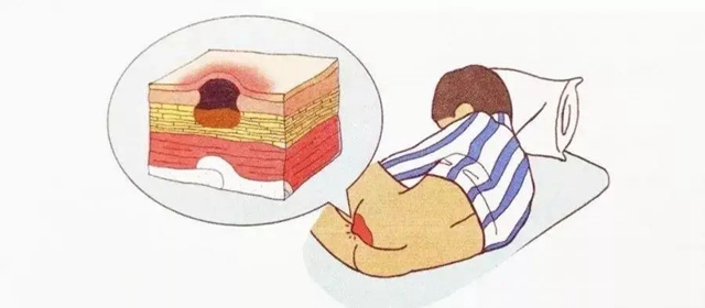 西南医大附院康健中心院区伤口造口淋巴水肿门诊开诊啦！看看哪些疾病要找它？