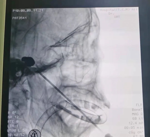 泸州一老人脸被“刀割”，痛不欲生！(图2)