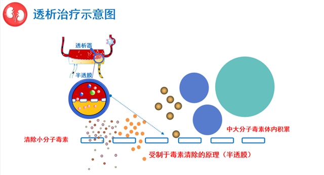 尿毒症患病率高达万分之9左右！该如何保护你的肾？(图3)