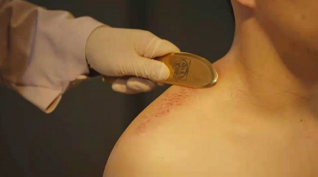 【扩散】爆火的中医特色诊疗技术，不限额免费体验！(图3)