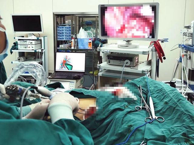 “诊”“治”一站式解决！泸州市人医胸心外科成功开展精准微创肺段切除术