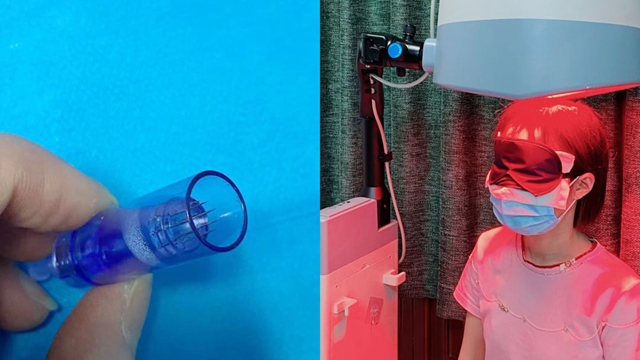 头发渐渐消失！给你1个治法