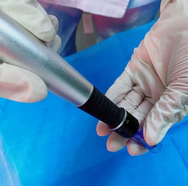 头发渐渐消失！给你1个治法(图5)