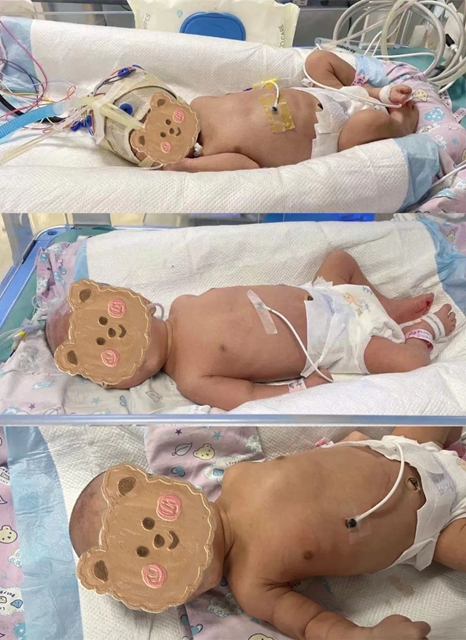 险！一场从云南到泸州的全力抢救(图3)