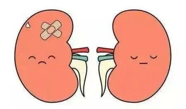 【关注】宜宾一男子遭了，输尿管里安支架！