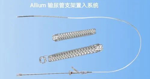 【关注】宜宾一男子遭了，输尿管里安支架！(图4)