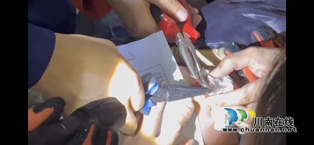 电动指甲钳夹住女童嘴　合江消防及时解围(图8)