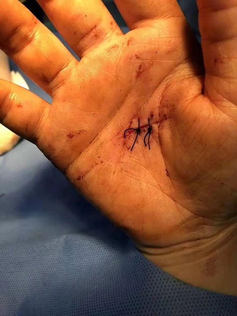 惊险!病房有人打破窗玻璃往外跳?危急时刻……(图4) 跳4.jpg