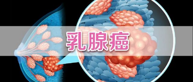 围剿“红颜杀手”，西南医大附院MDT团队发表罕见病例报道登上全球顶级期刊