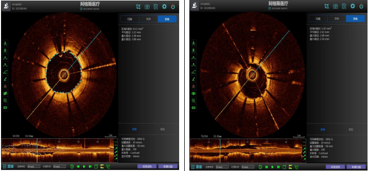 【关注】首例开展,西南医大中医院再创新高!(图5) 微信图片_20220813081301.png
