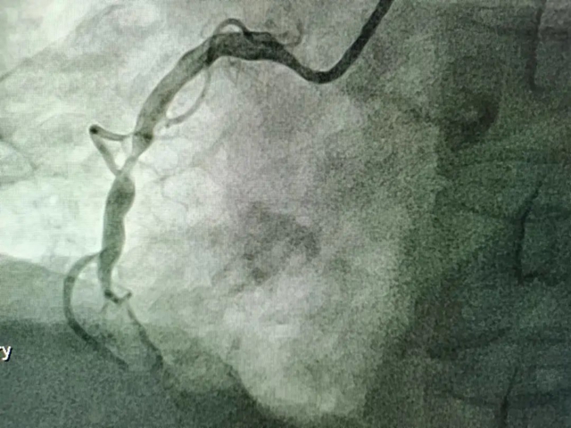【扩散】福音!看个病省了5万多……(图3) 3.jpg
