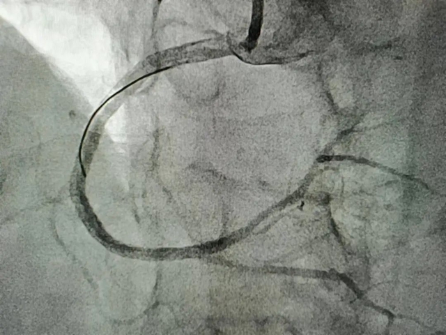 【扩散】福音!看个病省了5万多……(图4) 4.jpg