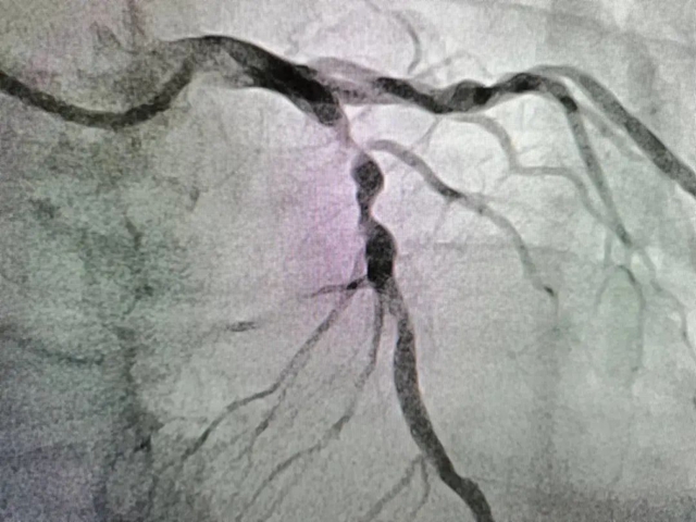 【扩散】福音!看个病省了5万多……(图5) 5.jpg