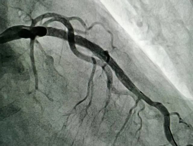 【扩散】福音!看个病省了5万多……(图6) 6.jpg