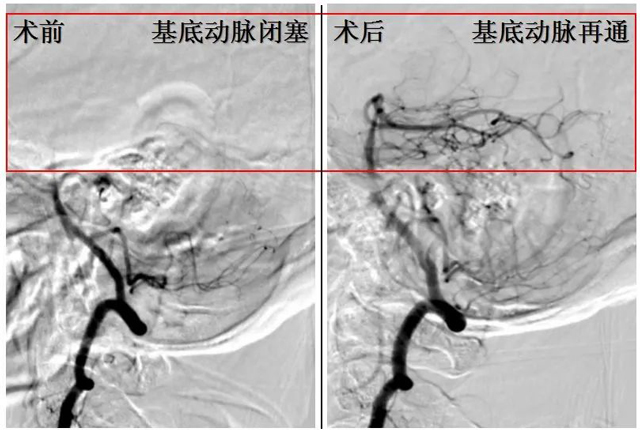 【警惕】泸州大叔,无意识长达8小时……(图3) 3-1.jpg