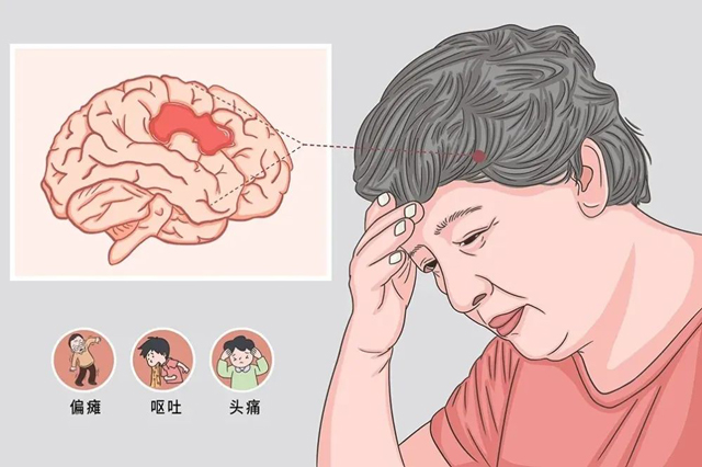 【警惕】泸州大叔,无意识长达8小时……(图6) 6-1.jpg