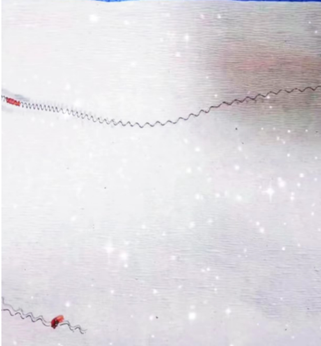 【当心】医生说:“身体里的这个东西一定要取出来!”女性朋友注意了……(图3) 微信图片_20230825094255.png