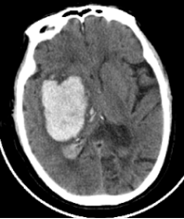 【健康科普】出现这种异常，请立即到医院就诊！