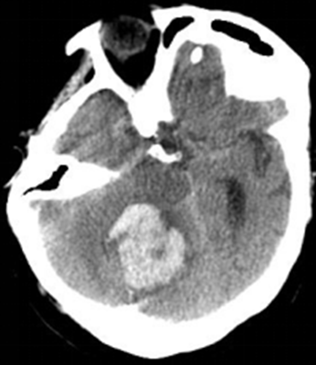 【健康科普】出现这种异常,请立即到医院就诊!(图2) 微信图片_20231009093133.png
