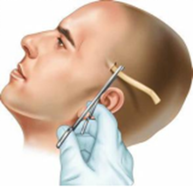 【健康科普】出现这种异常,请立即到医院就诊!(图4) 微信图片_20231009093151.png