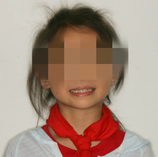 【自查】你家孩子有没有这个问题？再不矫正就晚了……