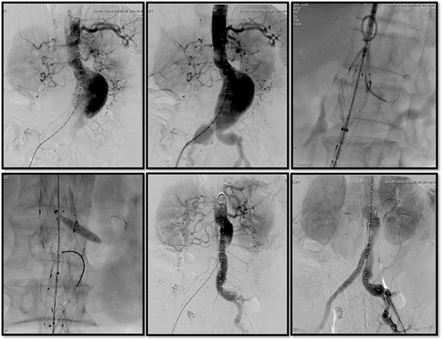 【警惕】肚子里的“不定时炸弹”,要当心……(图4) 4.jpg