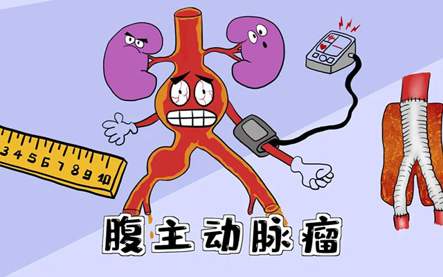 【警惕】肚子里的“不定时炸弹”,要当心……(图6) 6.jpg