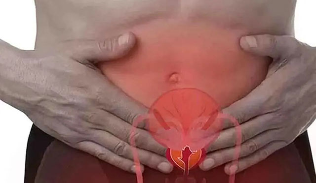 【警惕】上了50岁，一半男性都有排尿问题