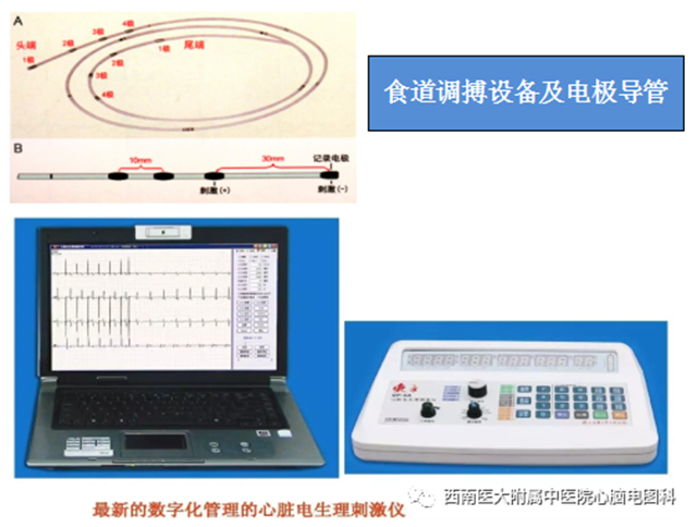 【警惕】心跳加速,一查竟是……(图3) 微信图片_20231023094723.png