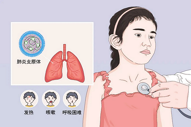 【提醒】肺炎支原体感染来了,儿童需特别注意(图3) nEO_IMG_3.jpg