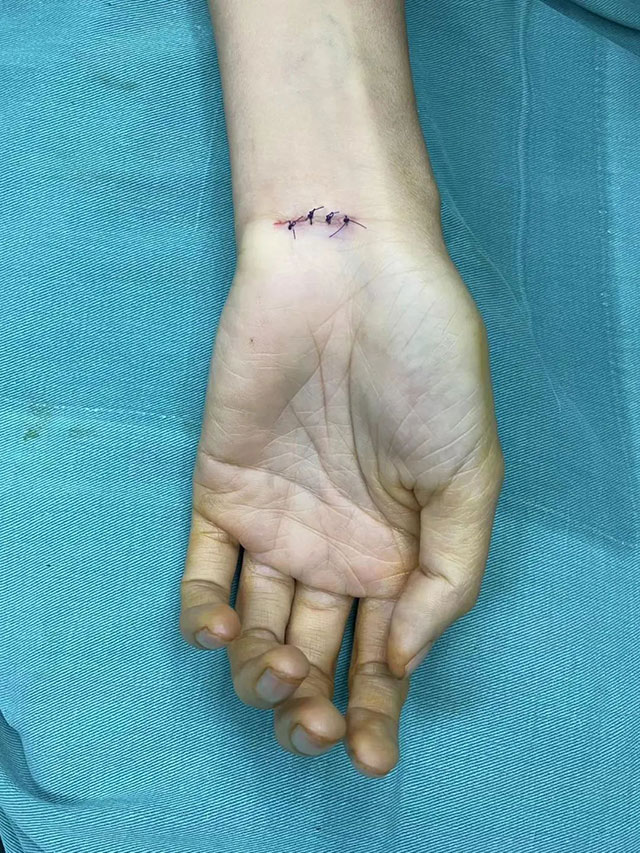 你的手麻?一剪没(图2) 2.jpg