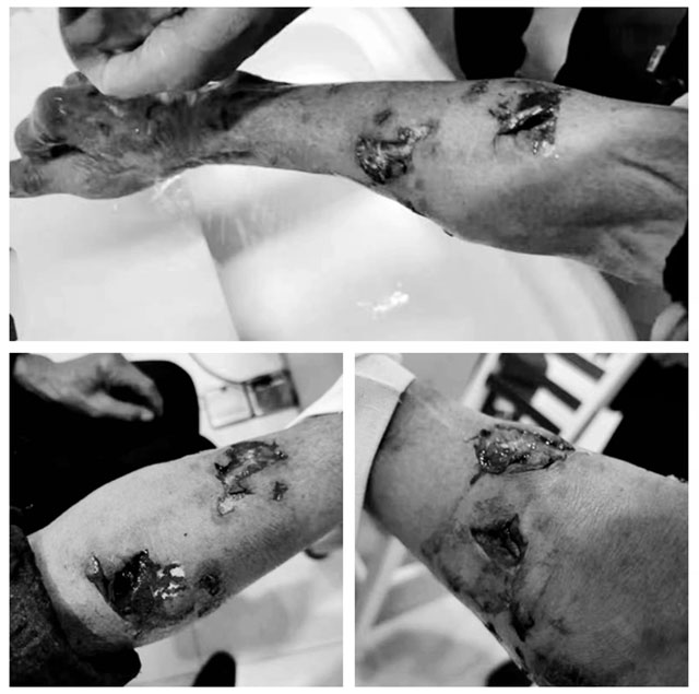 【关注】泸州男子被狗连咬数口，皮都咬lia了……