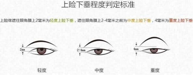 【围观】80岁大爷也来整形?(图2) 微信图片_20231225102017.png