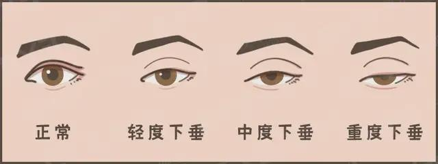 【围观】80岁大爷也来整形?(图3) 微信图片_20231225102022.png