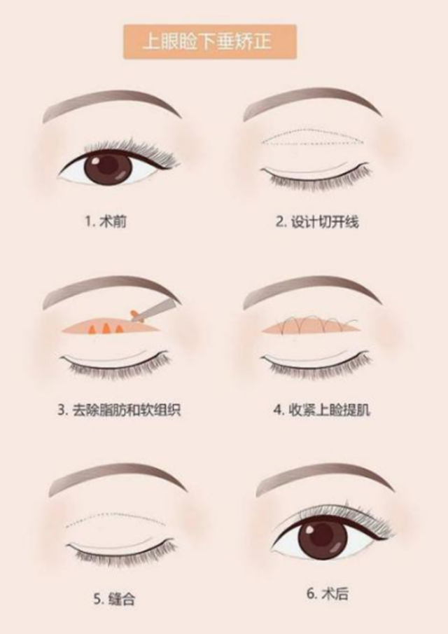 【围观】80岁大爷也来整形?(图4) 微信图片_20231225102027.png