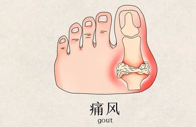 【警惕】放纵享受，19岁男生长出……