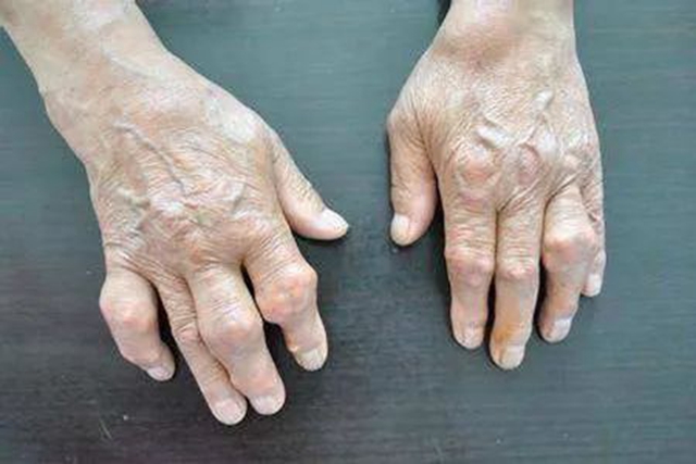 【警惕】放纵享受,19岁男生长出……(图4) 4.jpg