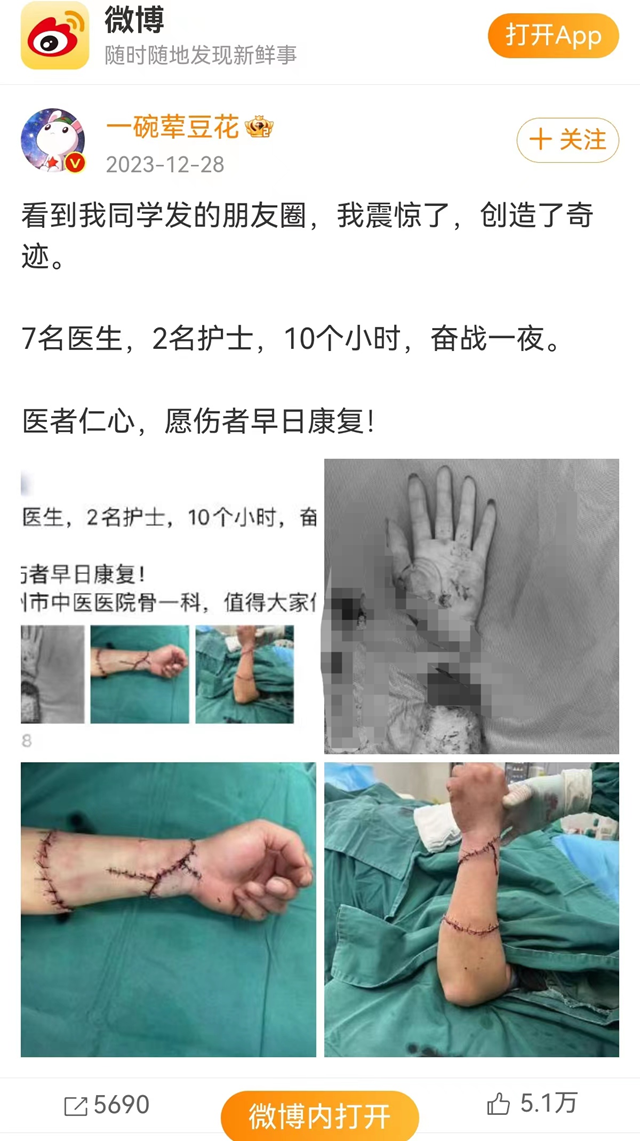 冲上热搜！泸州医生让患者断肢再续，网友纷纷评论......