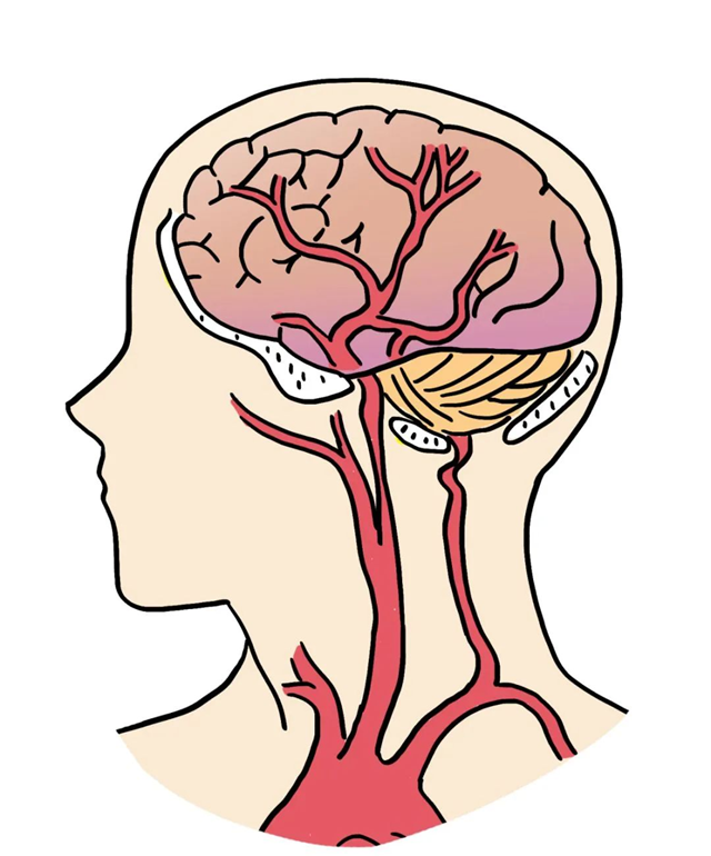 【扩散】不想得脑梗,饭后这3件事少做!(图6) 微信图片_20240116090424.png