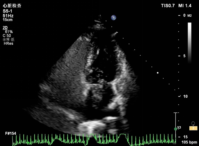 【关注】20岁女孩偏头痛,竟是因“心眼儿”多(图4) 微信图片_20240118091211.png