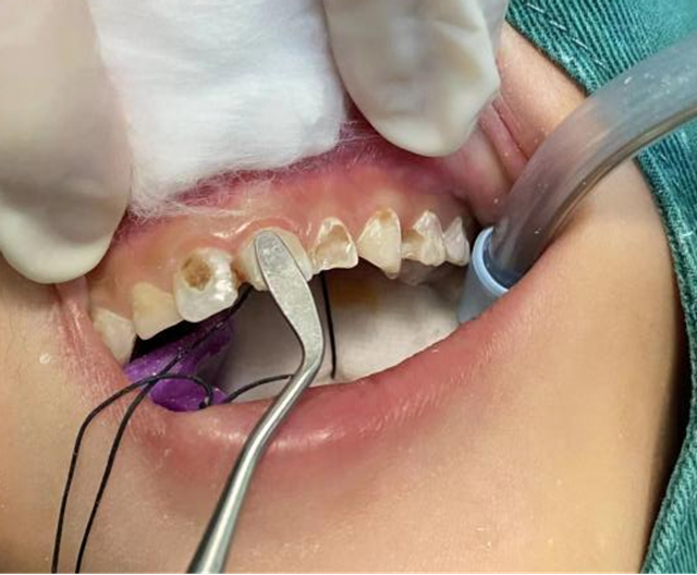 【关注】睡一觉,一口烂牙好了……(图3) 微信图片_20240312092118.png