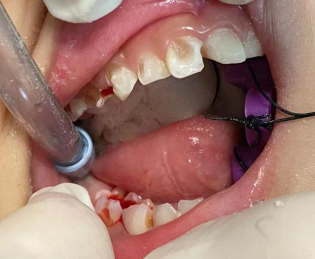 【关注】睡一觉,一口烂牙好了……(图4) 微信图片_20240312092123.png