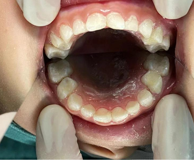 【关注】睡一觉,一口烂牙好了……(图5) 微信图片_20240312092127.png