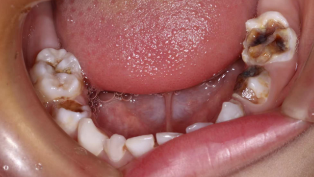 【关注】睡一觉,一口烂牙好了……(图8) 微信图片_20240312092147.png