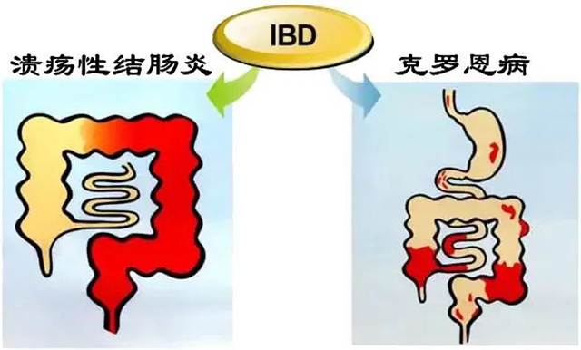 号称“不死的癌症”，看看中招没有？