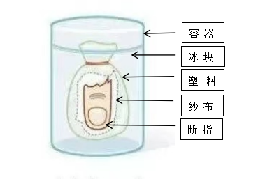 【专科技术】惊心！又是电锯！装修师傅们千万要小心了！