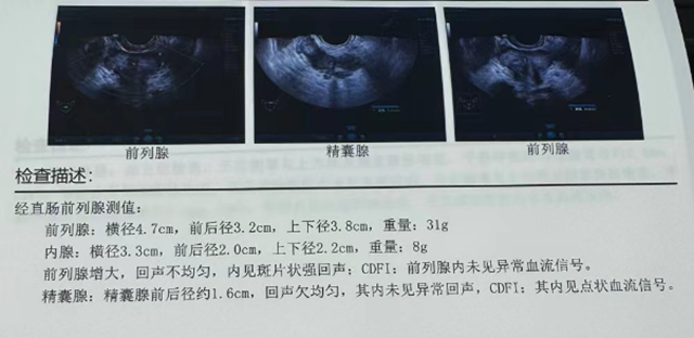 【扩散】男子36岁就中招！一个习惯，让这种病提前20年？